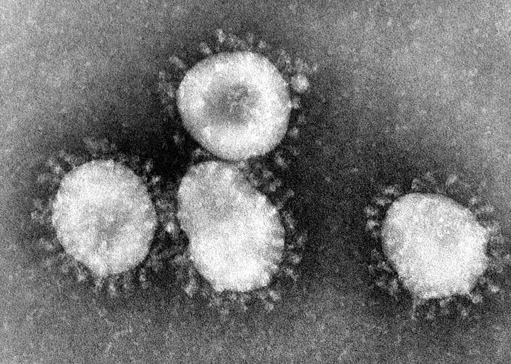Ghana : le pays s'apprête à faire face au Coronavirus après les premiers cas suspectés en Afrique