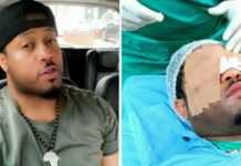 Nigeria : la star de Nollywood Mike Ezuruonye se fait opérer des yeux