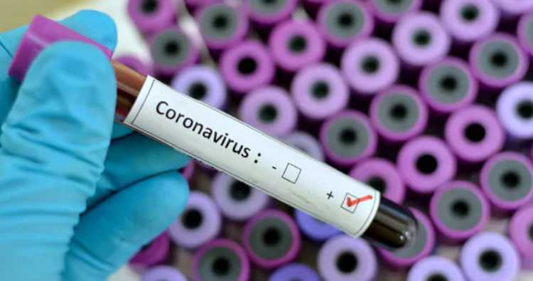 Coronavirus : la Guinée rejoint le trio des pays les plus touchés en Afrique de l'Ouest